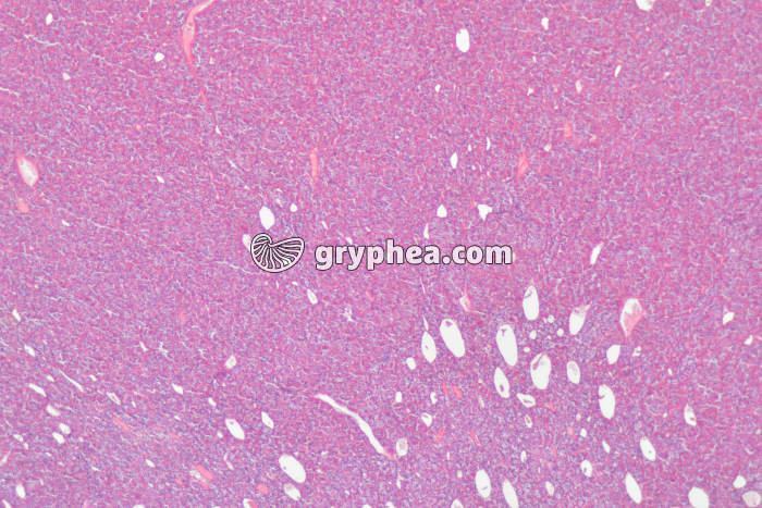 Hypophyse antérieure CS x 10 - gryphea.com